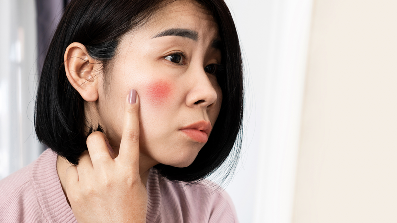 Thoa trực tiếp mủ trôm lên da có thể gây kích ứng da