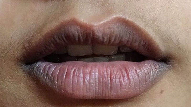 Tác hại của phun môi, xăm môi mà bạn không nên chủ quan 4