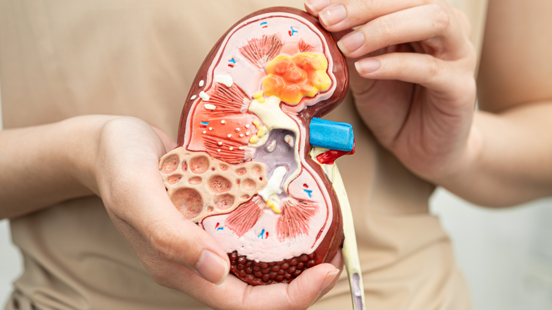 Su su chứa axit oxalic có thể làm tăng nguy cơ sỏi thận