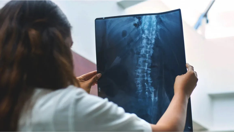 Tác hại của suy thận mà nhiều người không biết 3