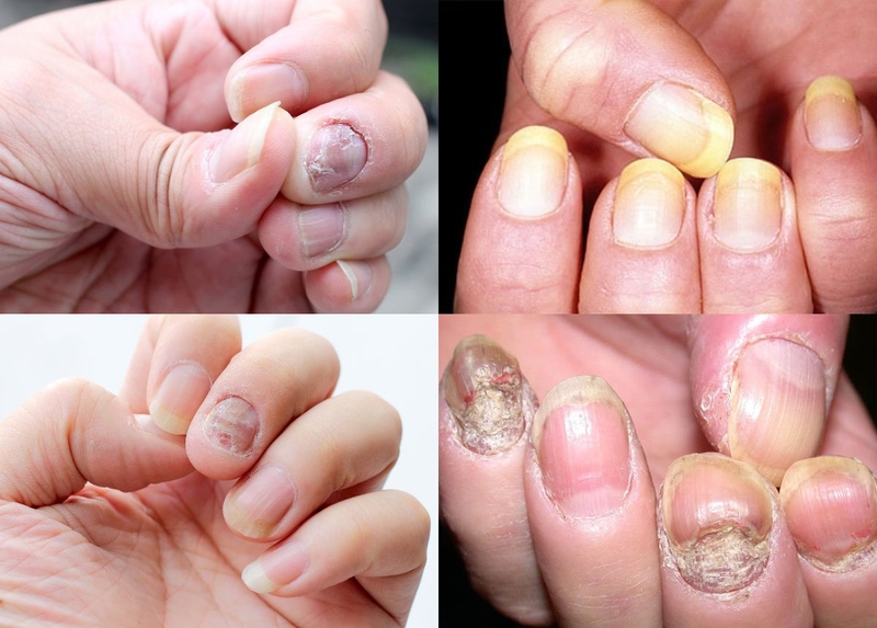 Tìm hiểu 7 tác hại của thiếu canxi đối với sức khỏe cơ thể 2