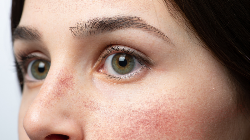 Nước đá lạnh có thể tước đi lớp màng ẩm tự nhiên bảo vệ bên ngoài