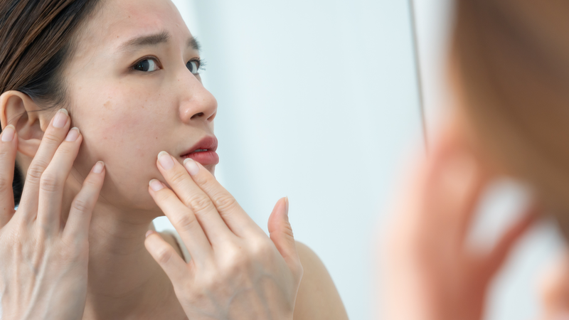 Nhiệt độ thấp sẽ kích thích các lỗ chân lông trên mặt se khít lại