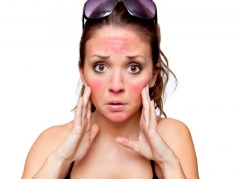 Tác hại không lường của việc tẩy trắng da quá mức1