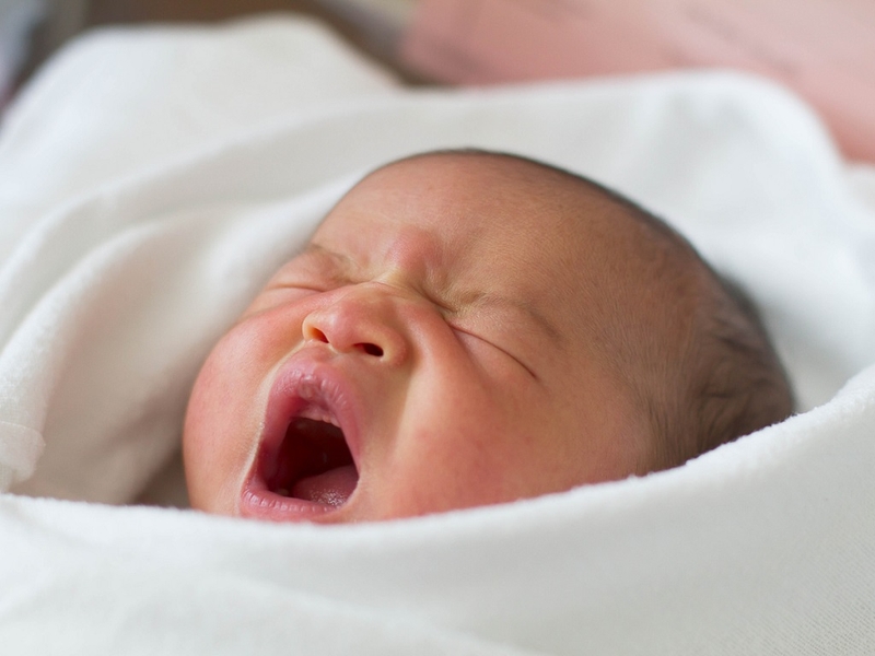 Tắc lệ đạo bẩm sinh: Nguyên nhân, triệu chứng, cách chẩn đoán và điều trị bệnh 1