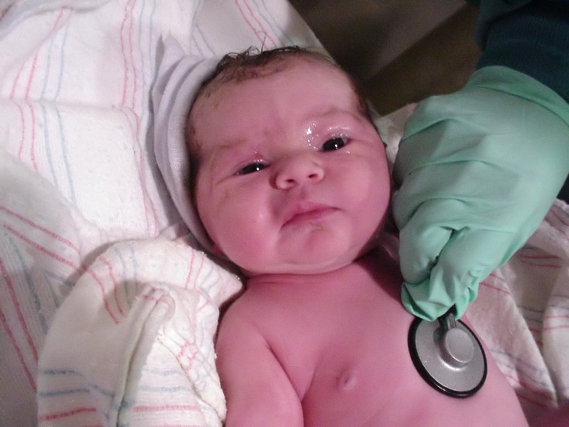 Tắc lệ đạo ở trẻ sơ sinh và cách thông lệ đạo cho trẻ 3