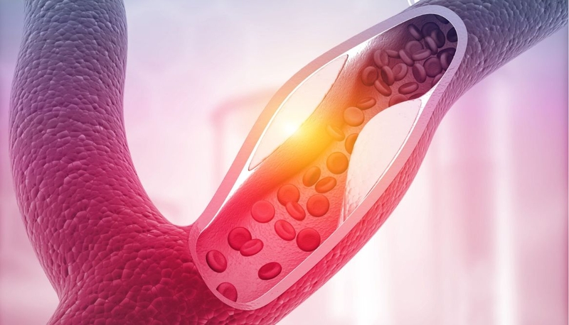 Tắc nghẽn mạch máu não có chữa được không? Thời điểm vàng để cứu chữa 1