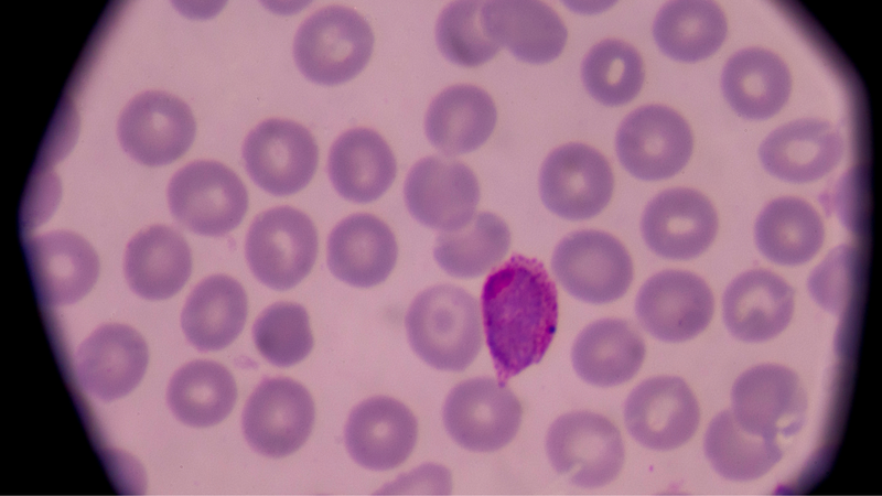 Tác nhân gây bệnh sốt rét là gì? 1