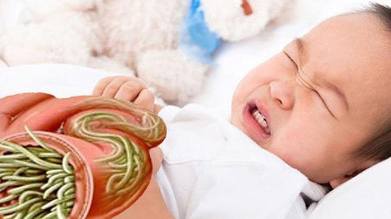 Tắc ruột vì giun đũa: Nguyên nhân, triệu chứng và cách điều trị hiệu quả 1
