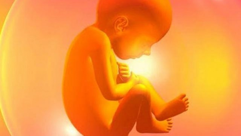 Đa ối là một trong những triệu chứng của tắc tá tràng bẩm sinh trước sinh