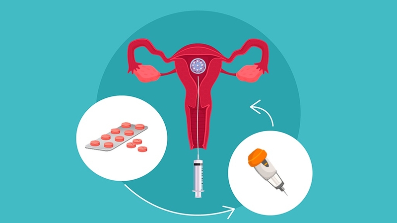 Tắc vòi trứng có làm IUI được không? Những điều bạn cần biết 3