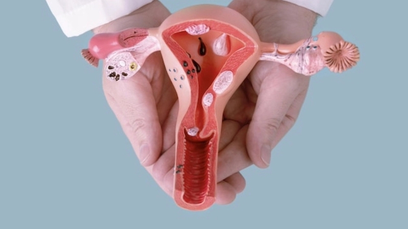 Tắc vòi trứng có rụng trứng không? Các phương pháp điều trị tắc vòi trứng 3