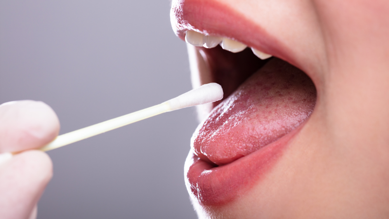 tach-chiet-adn-la-gi-yeu-to-anh-huong-den-qua-trinh-tach-chiet-adn 3