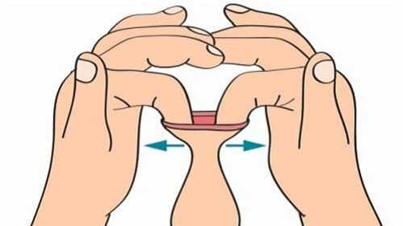 Tách dính bao quy đầu tại nhà: Cách làm an toàn và hiệu quả 3