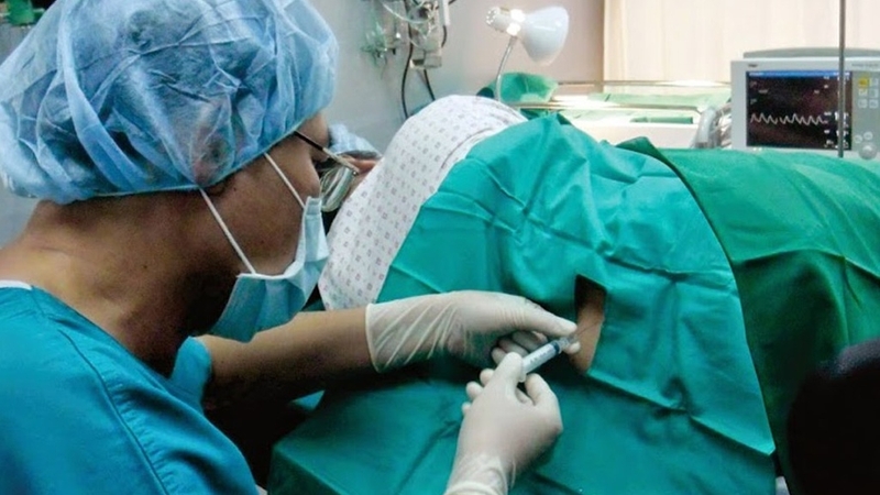 Tai biến gây mê: Nguyên nhân, triệu chứng và cách phòng ngừa 1