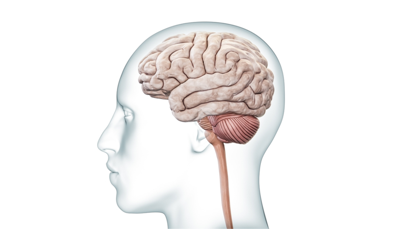 Tai biến mạch máu não vùng thân não 1