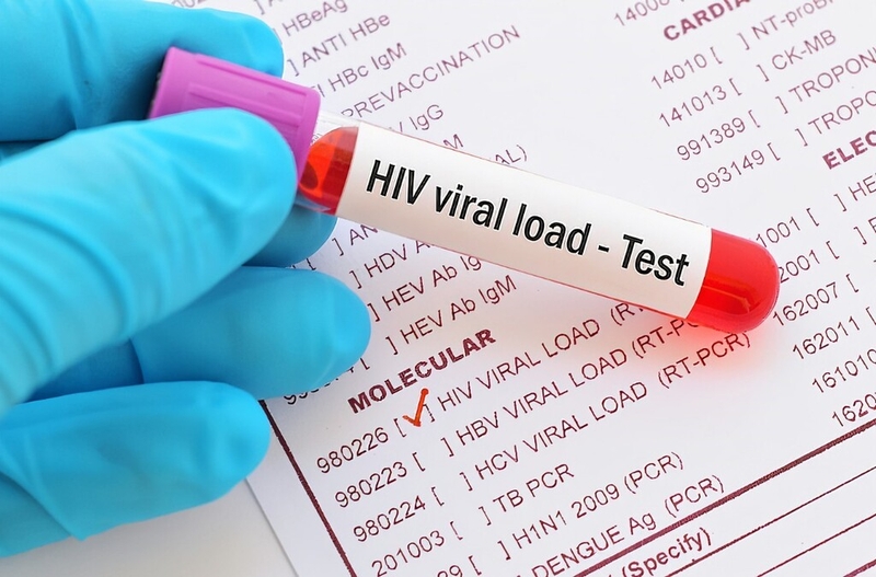 Tải lượng virus là gì? Khi nào cần thực hiện xét nghiệm tải lượng virus? 2