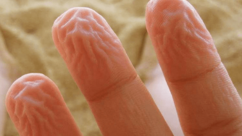 Tại sao da tay bị nhăn khi gặp nước