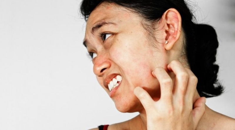 Nguyên nhân tại sao khi đắp mặt nạ bị châm chích 2