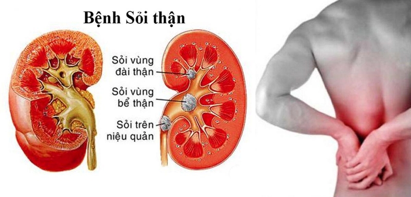 Tại sao không nên uống vitamin c vào buổi tối sau khi sinh mổ?