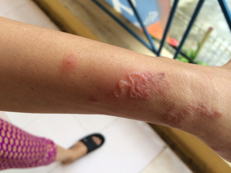 Tại sao lại nhiễm ký sinh trùng não? -3