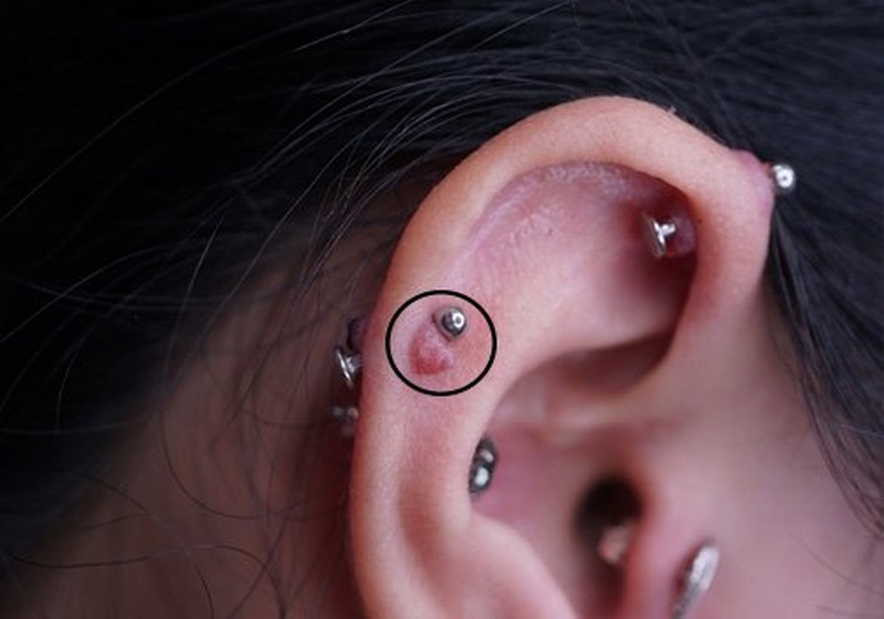 Sử dụng thuốc mỡ sau khi bẩm lỗ tai để vết thương phục hồi tốt hơn