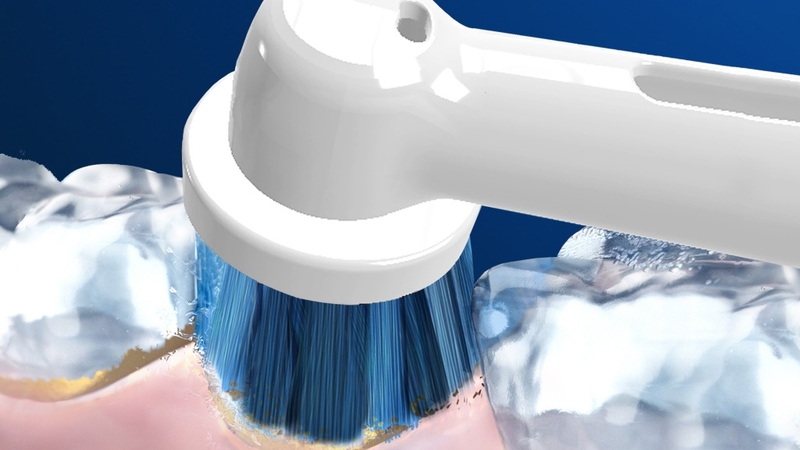 Tại sao nên lựa chọn đầu bàn chải điện Oral-B Ultrathin EB60? 2