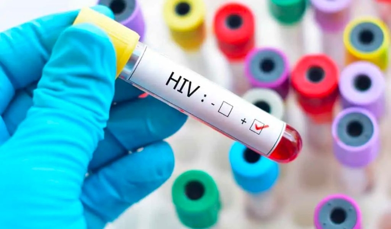 Tại sao nhiều người không biết mình bị nhiễm HIV? Dấu hiệu nhận biết 3