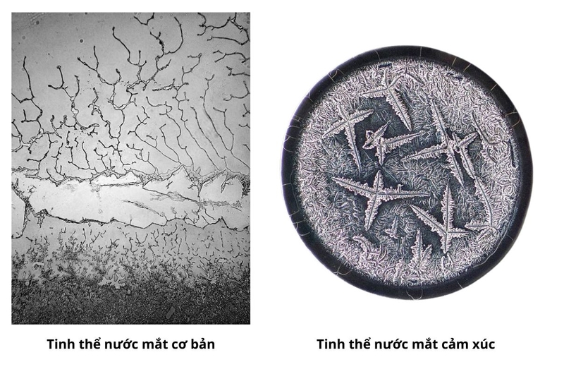 Tại sao nước mắt lại mặn? Thành phần nước mắt có gì 2