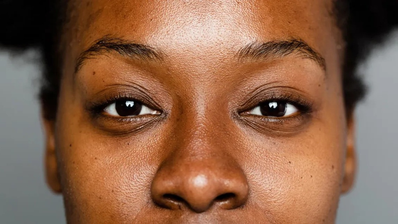 Tại sao ở trong nhà không ra nắng mà da vẫn bị đen sạm? 2