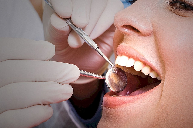 Tại sao răng ê buốt sau khi trám? Cách khắc phục như thế nào? 1