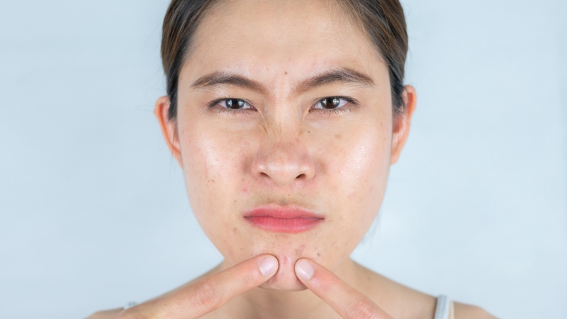 Tại sao sáng ngủ dậy mặt nhiều dầu​? Nguyên nhân và cách khắc phục hiệu quả 2