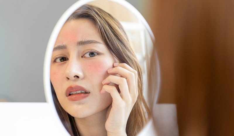 Tại sao tẩy da chết xong bị ngứa? -3