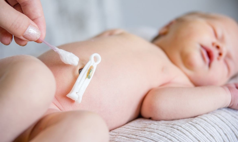 Vùng rốn chưa khô vẫn cần được tiếp tục chăm sóc và vệ sinh đúng cách