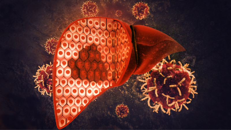 Tại sao ung thư gan khó phát hiện? 1