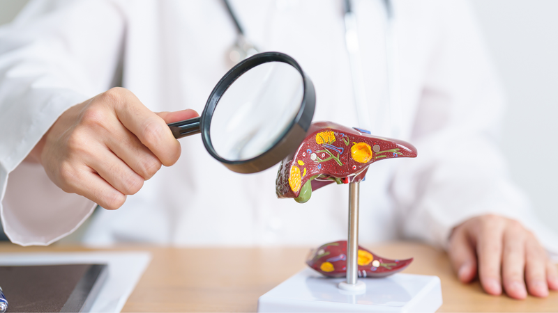 Tại sao ung thư gan khó phát hiện? 2