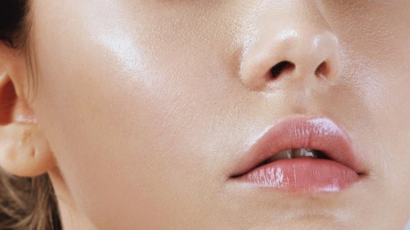 Uống vitamin C bị nổi mụn thường gặp ở người có cơ địa da dầu