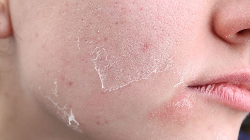 Tái tạo da bị ngứa: Nguyên nhân và cách chăm sóc ra sao? 2