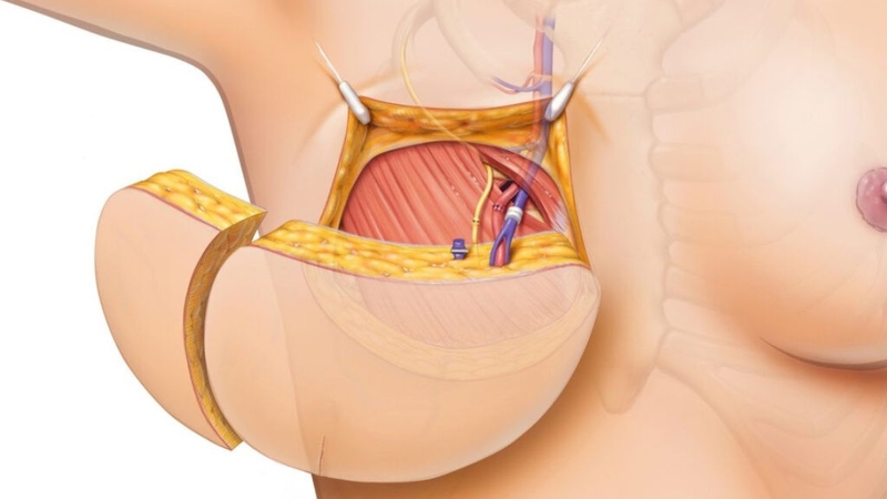 Người bệnh được thăm khám, đánh giá, tư vấn kỹ trước phẫu thuật