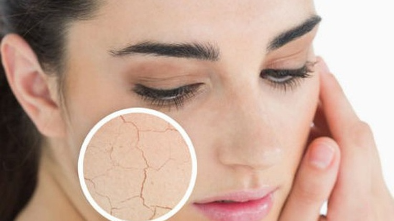 Vitamin c uống cách kháng sinh bao lâu 2