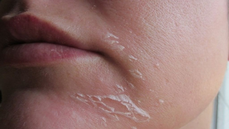 Tắm nước nóng lâu có tốt không? Cần lưu ý gì? 3