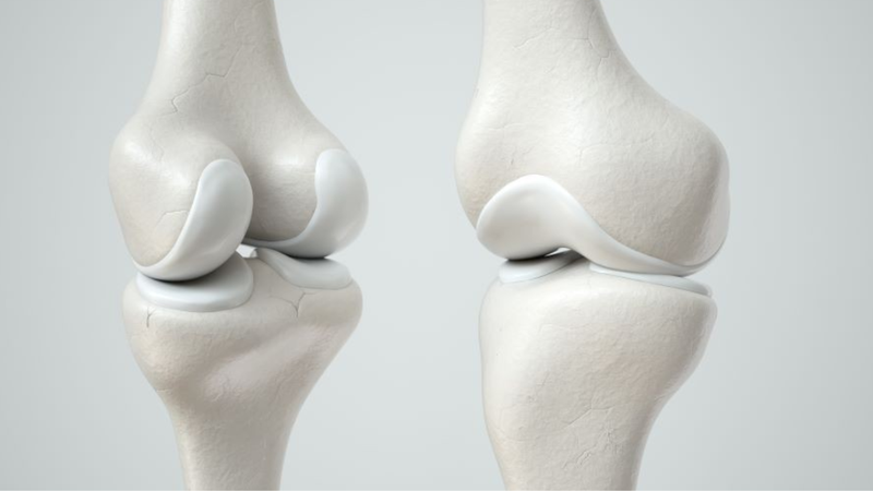 Tầm quan trọng của sụn xương đối với cơ thể 2