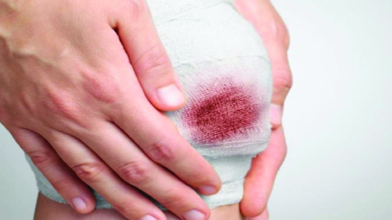 Tầm quan trọng của việc sát khuẩn ngoài da trước các yếu tố bên ngoài 1