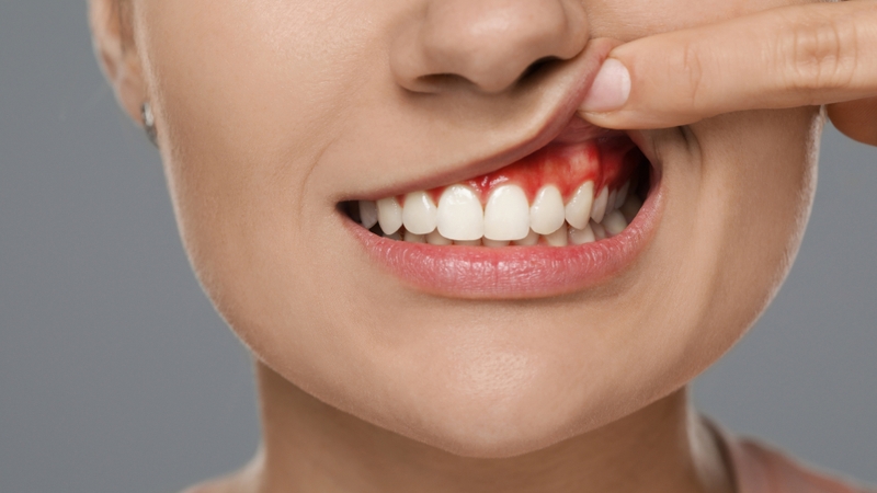 Vitamin C có tác dụng gì? Cách bổ sung vitamin C hiệu quả với cơ thể người 3