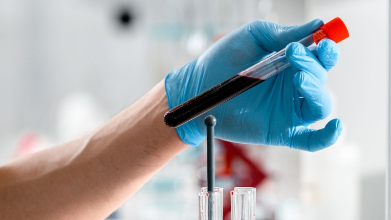 Tầm quan trọng của xét nghiệm NIPT 3 trong thai kỳ