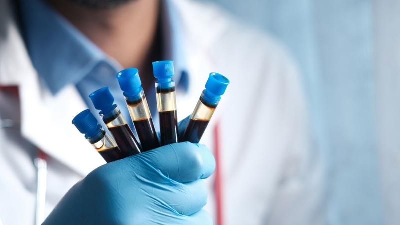 Tầm soát ung thư dương vật: Rất cần thiết cho nam giới! 3