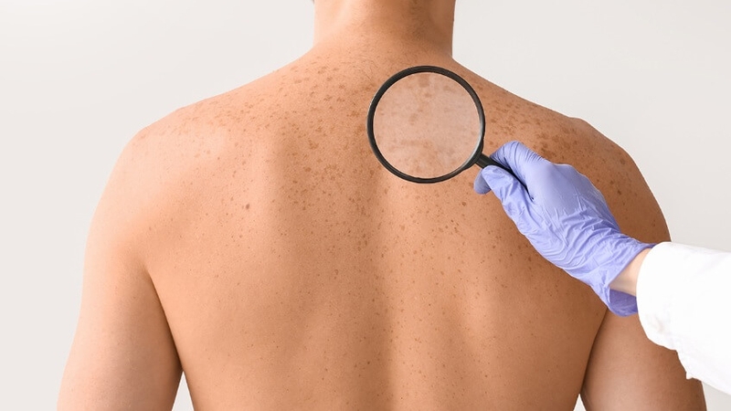 Tắm trắng khô là gì? Có tốt không? 2