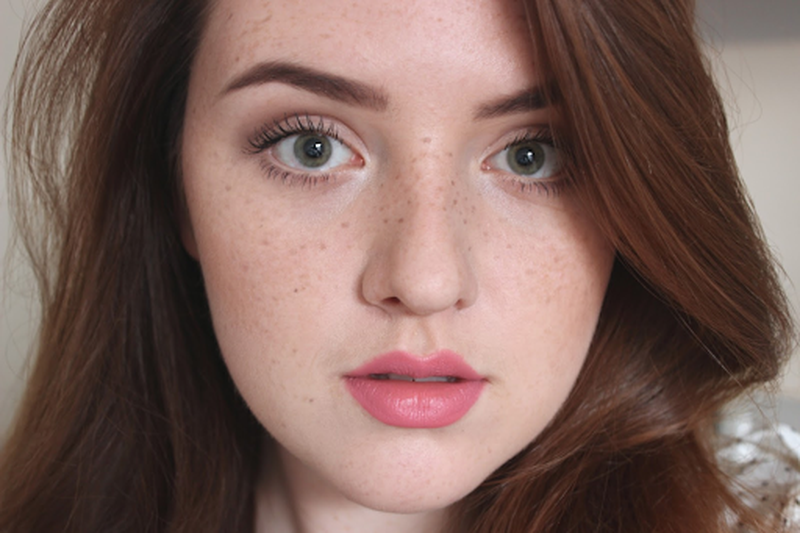 Tàn nhang đốm nâu - nỗi lo sợ của chị em phụ nữ1