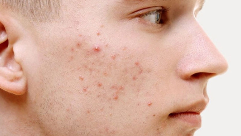 Tăng cường độ đàn hồi da với serum vitamin E và vitamin C 3