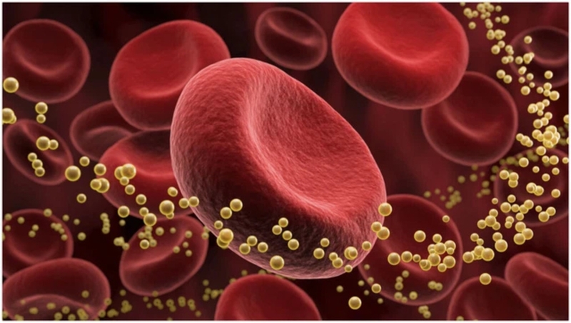 Tăng lipid máu trong hội chứng thận hư: Nguyên nhân, triệu chứng và cách điều trị 1